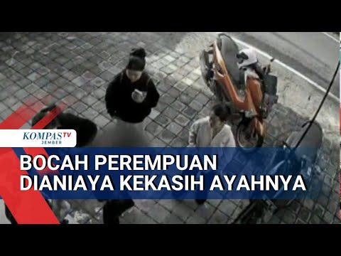 Bocah Bali Usia 11 Tahun Dianiaya, Pelaku Kekasih Ayah Sendiri