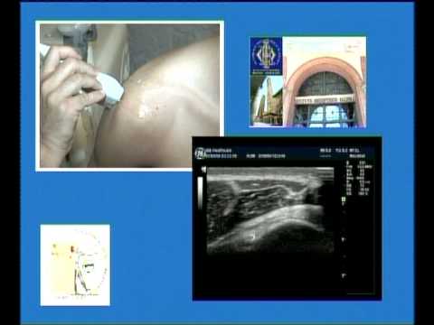 Morel infusione per giunti Lamaro in bocca osteocondrosi