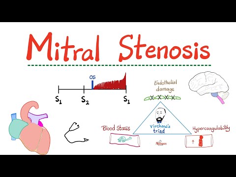 Mitral Stenosis (MS) - Valvular Heart Disease (VHD) - Mitral Valve Stenosis - Cardiology Series