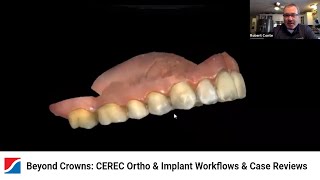 Beyond Crowns: CEREC Ortho & Implant Workflows & Case Reviews