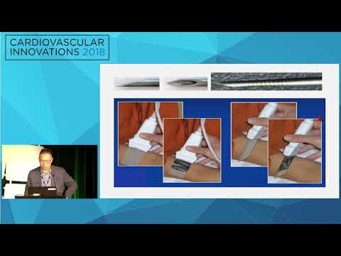 CVI2018 Session: Access selection for Below knee tibial disease and how