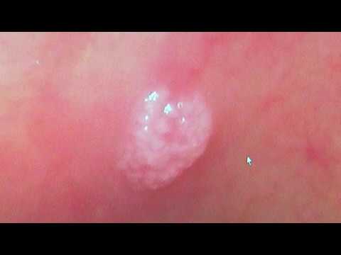 Your Healthy Family: April is oral cancer awareness month