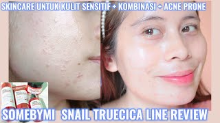 Download lagu SKINCARE UNTUK KULIT SENSITIF KOMBINASI ACNE PRONE |REVIEW SOMEBYMI SNAIL TRUECICA mp3 Download lagu SKINCARE UNTUK KULIT SENSITIF KOMBINASI ACNE PRONE |REVIEW SOMEBYMI SNAIL TRUECICA mp3
