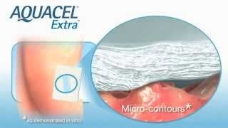 Product video: ConvaTec AQUACEL EXTRA Hydrofiber Dressing w/ Strengthening Fiber