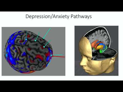 OHBM 2025 | Educational Course | How to Use MRI to Optimize Brain Stimulation | Part 8