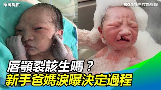 有胎動了…唇顎裂該生嗎？爸媽淚曝決定過程