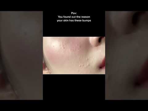 Cerave hydrating cleanser with Clogged pores, close comedones #skincare #closedcomedones