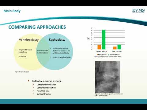Thumbnail image of video presentation for Cementing the Fracture: Comparing Approaches to Percutaneous Vertebral Augmentation
