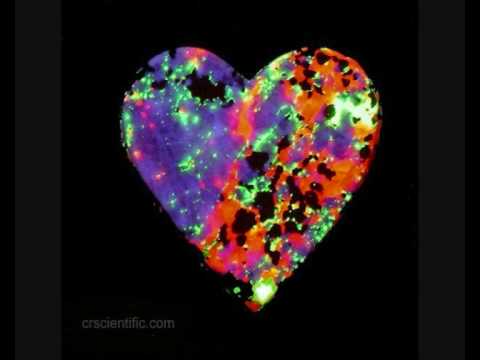 AdotR - make up your mind_0001.wmv