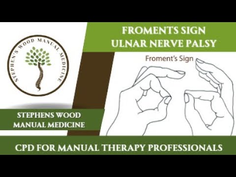 Froment's Sign for Ulnar Nerve Palsy