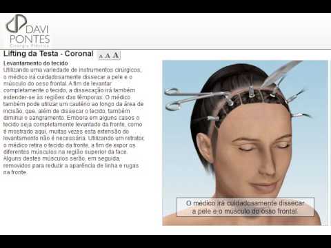 Omeopatia ad alta potenza Ha chimica influisce sulla potenza