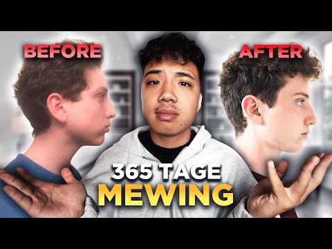 Durch Zungenposition ein attraktives Gesicht bekommen? (Mewing Test)