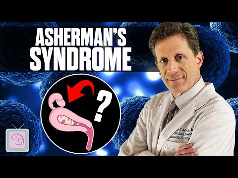 Fertility problems Miscarriages Could you have Asherman s Syndrome