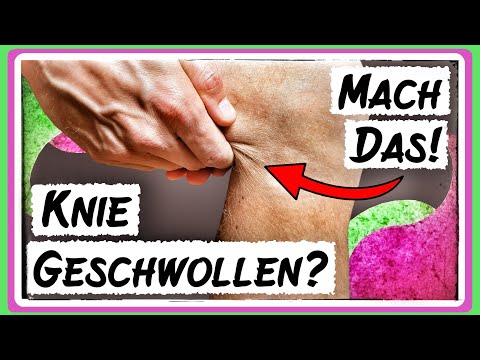 Behandle ein dickes Knie mit Wassereinlagerung, eine Knieschwellung, geschwollene Füße usw selbst!