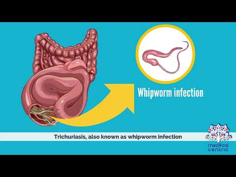 féreg whipworm kezelés