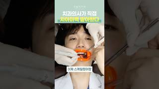 치아 미백 성형 시술