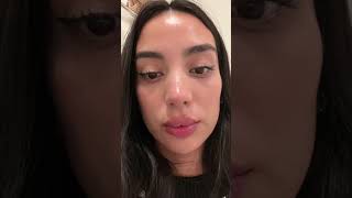 ME INYECTE LOS LABIOS 👄 Y SALIÓ MAL 😩.... bueno no tan mal 😂 Ácido hialurónico en labios