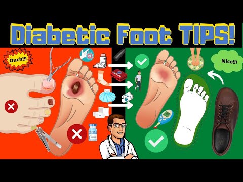 Heel Spurs Plantar Fasciitis BEST Home Treatment 2022