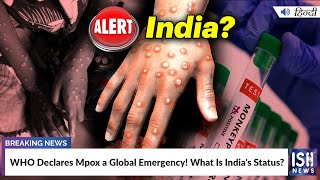 WHO Declares Mpox a Global Emergency! What Is India's Status?