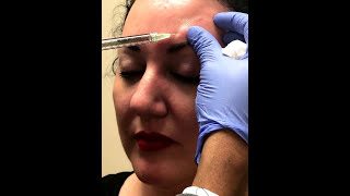 Botox in Three minutes in Denver