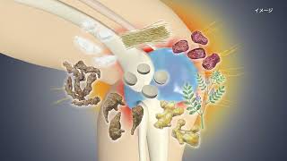 ミズナイン「ひざの水が原因」篇D（MZN-0301）