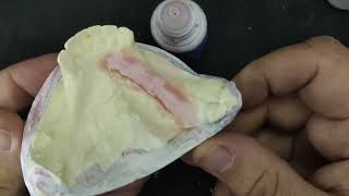 Curso de Prótese Flexível - Aula 03
