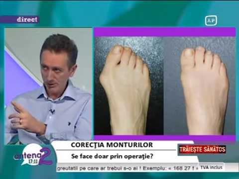 specialiști în tratamentul artrozei piciorului