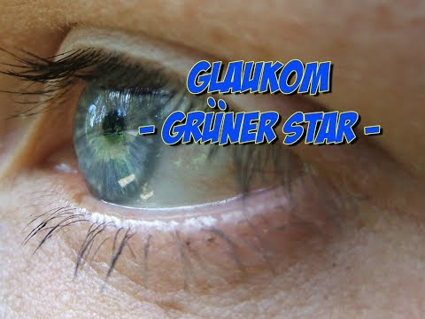 Erkrankungen der Augen - Glaukom oder grüner Star