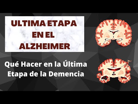 Qué Hacer en la Última Etapa de la Enfermedad de Alzheimer