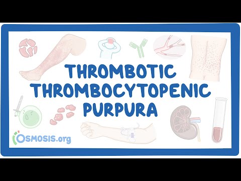 Thrombotic thrombocytopenic purpura (NORD)