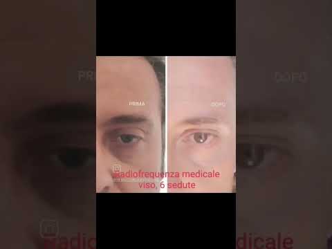 Massimiliano Giardina-6