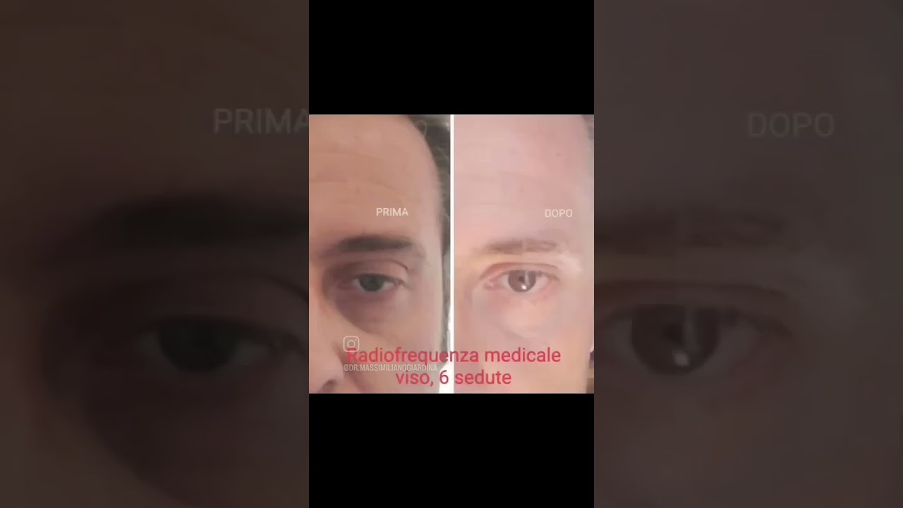 Massimiliano Giardina-6