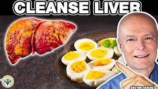 Top 10 SUPER FOODS That Can Heal A FATTY LIVER