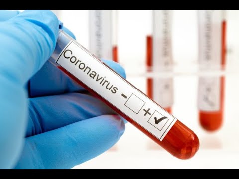 V Moldave sa spúšťa testovanie kolektívnej imunity KARUSEL 2.