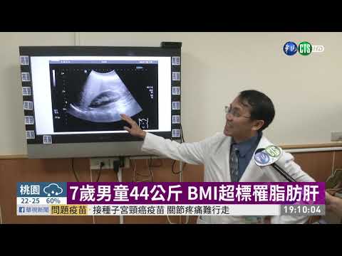 7歲男童44公斤 BMI超標罹脂肪肝