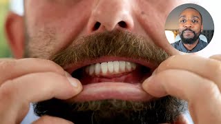 I spent £14,000 getting my teeth done in Turkey, DENTIST REACTS - 'It was the worst mistake...'