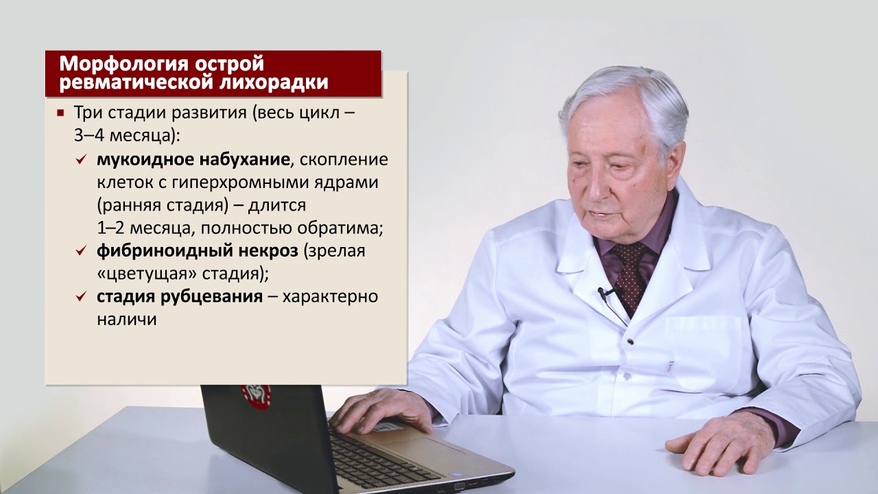 Острая ревматическая лихорадка