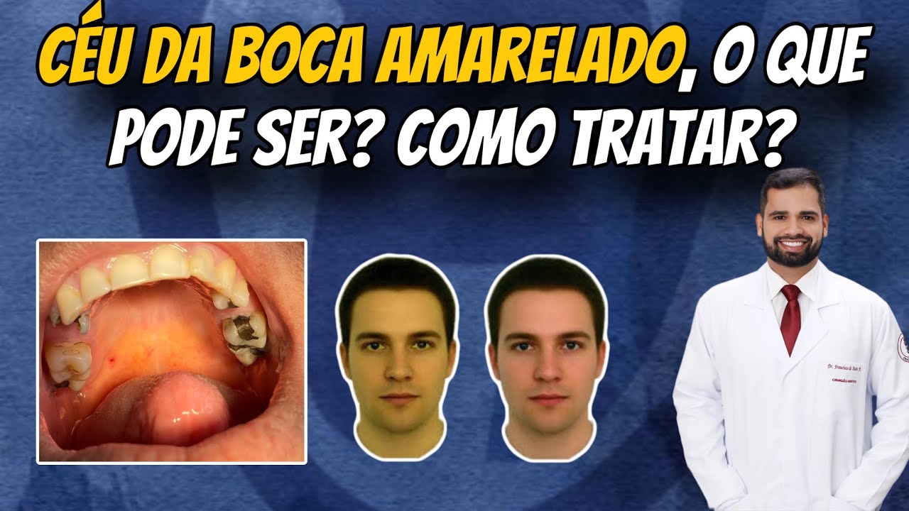 Francisco De Assis Almeida Lima Júnior-42