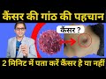 कैंसर की गांठ और नॉर्मल गांठ को कैसे प�