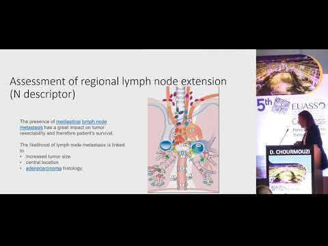 D. Chourmouzi - Epidemiology and staging of lung cancer