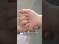 Pijat Dua Titik Ini Bisa Bantu Jaga Kesehatan Jantung