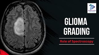 Glioma grading | Spectroscopy | Umamaheswara Reddy.V