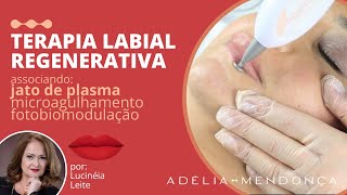 Protocolo Jato de Plasma na Terapia Labial para Volumização, Hidratação e Realce da Coloração