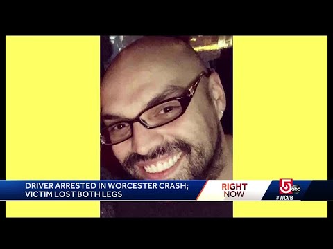 Man pinned between cars loses legs; driver charged with DUI