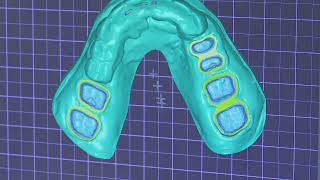 3D Dental Modeling Process