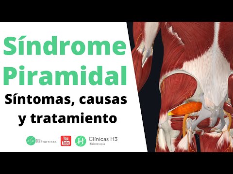 Síndrome piramidal dolor ingle. ✅Tratamiento síndrome piramidal | Clínicas H3