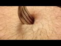 Fork In Navel