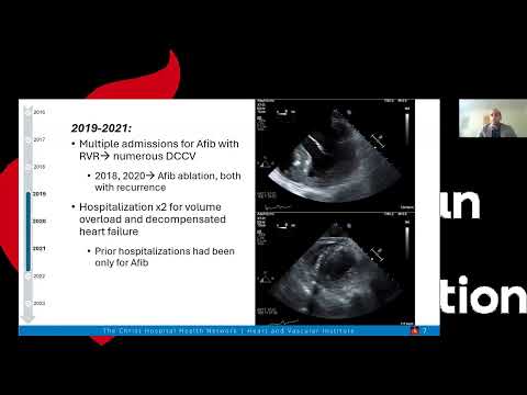 Hypertrophic Cardiomyopathy Webinar Series Part 2: Clinical Case Reviews and Insights