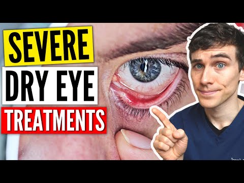 Severe Dry Eyes Treatment - Dry Eyes Treatment Guide