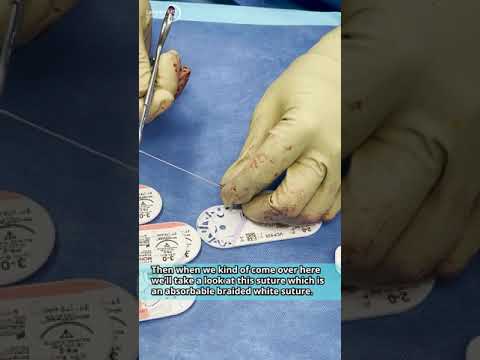 Common Plastic Surgery Sutures